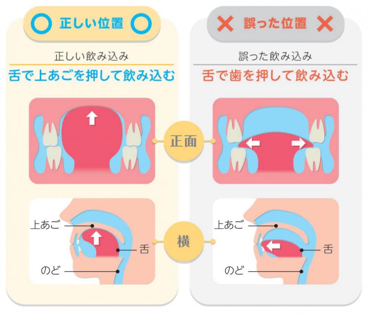 正しい舌（ベロ）の位置について